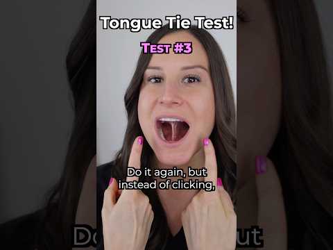 Do you have a Tongue Tie? (Quick test)