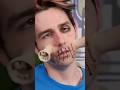 BOY GETS REAL LIFE SIREN HEAD SURGERY Shorts