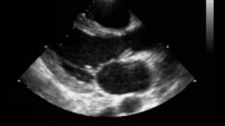 Kosheen - Empty Skies