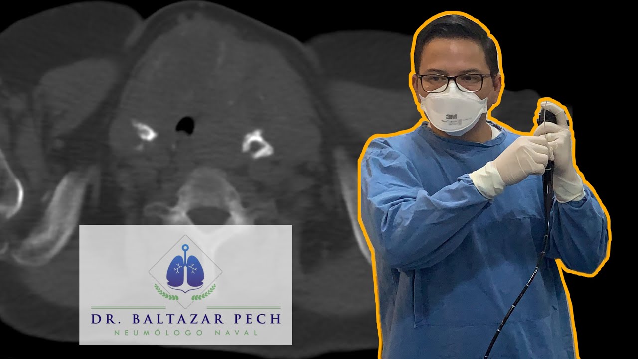 Baltazar Pech Alonso-20