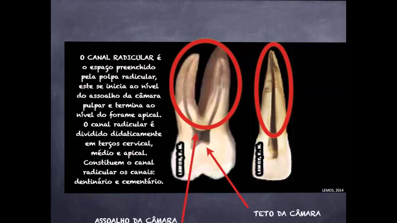 #01 Aula 1 Anatomia dentaria para endodontia