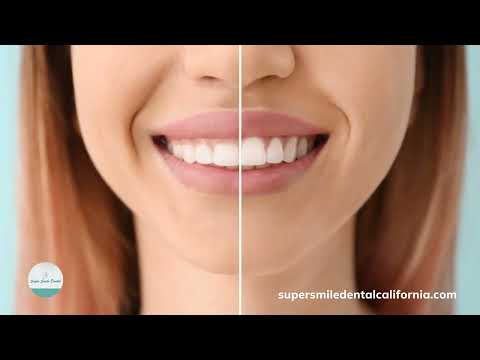 Atención dental para usted y su familia