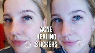 HOW TO GET RID OF A BLEMISH OVERNIGHT | MASKERAIDE SPOTTED CLEANSING DOTS REVIEW | KARLI BRAND
