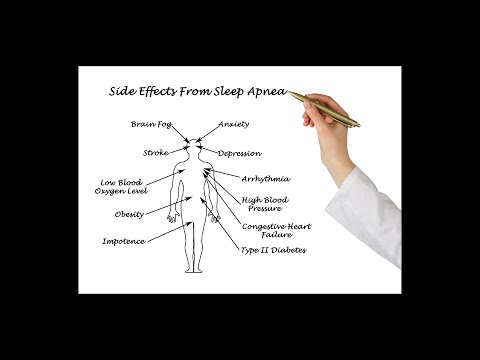 Sleep Apnea's Side Effects