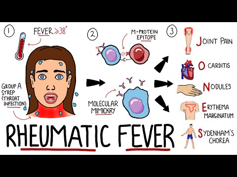 Rheumatic Fever Made Easy (Including Jones Criteria and Mnemonic!)