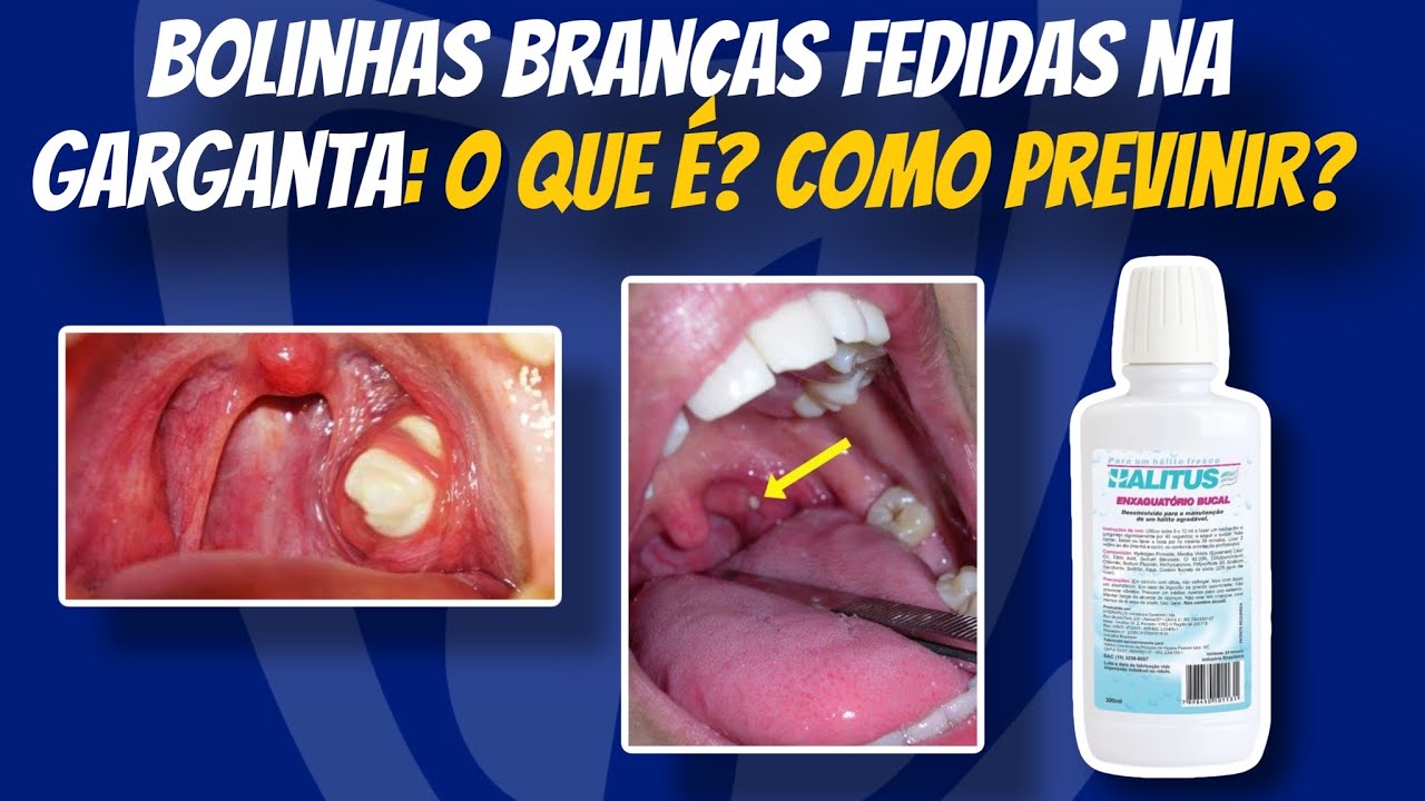 Francisco De Assis Almeida Lima Júnior-72