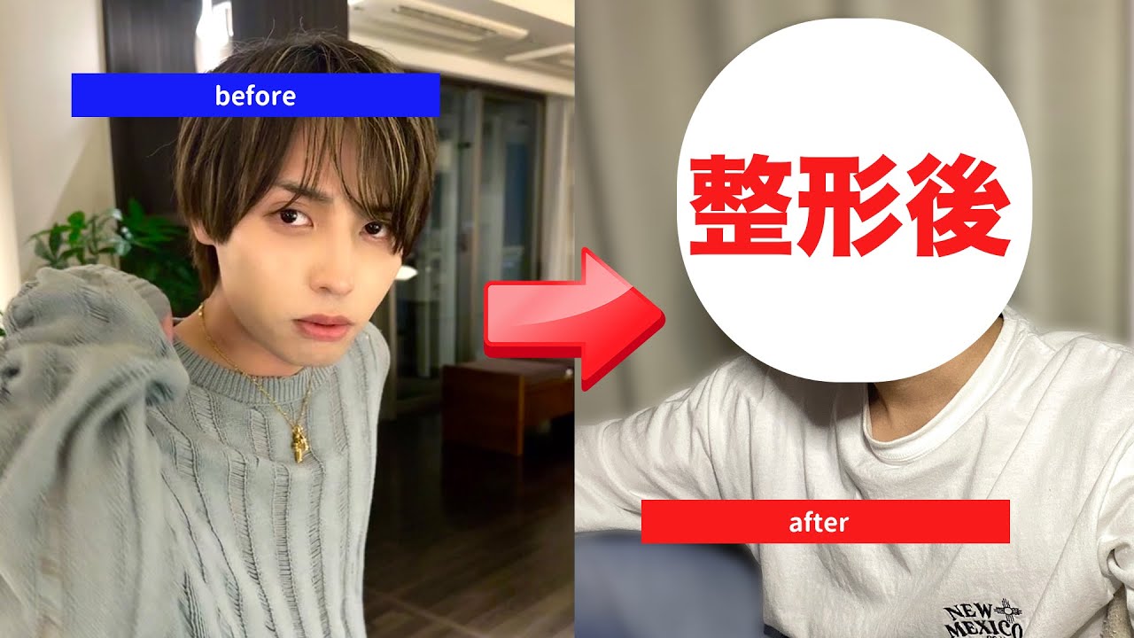 遂に整形してしまいました