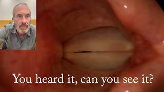 How to hear and see a voice problem — World Voice Day 2025