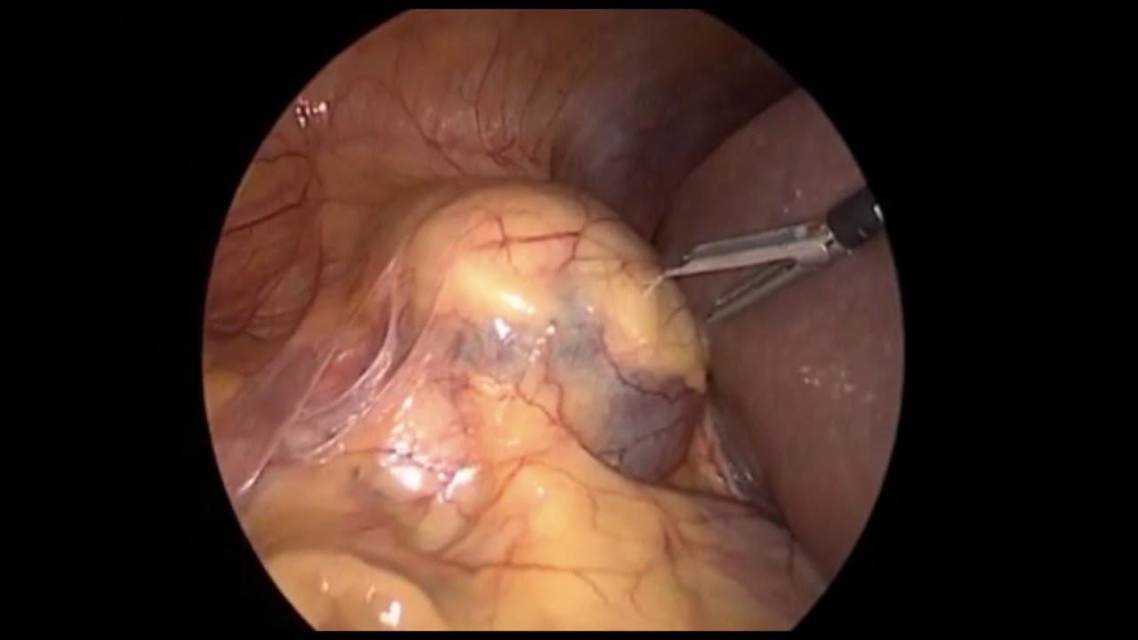 Gerardo Rodrigo Lemus Mena-14