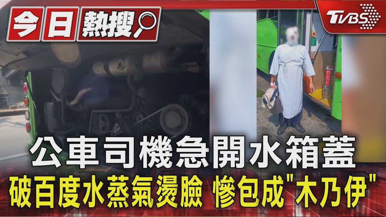 #獨家 公車司機急開水箱蓋 破百度水蒸氣燙臉 慘包成「木乃伊」｜TVBS新聞 @TVBSNEWS01