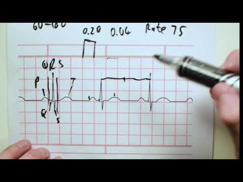 Basic ECG interpretation + Heart Blocks | That med guy