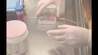 Lung co-culture models