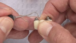 Chairside Live Episode 139: When Chairside Adjustments Go Wrong