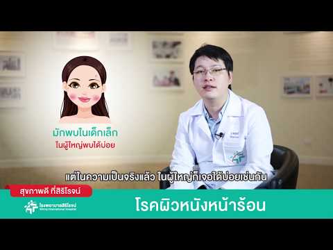 หญ้าในนามของโรคสะเก็ดเงิน ขี้ผึ้งยาปฏิชีวนะสำหรับกลาก