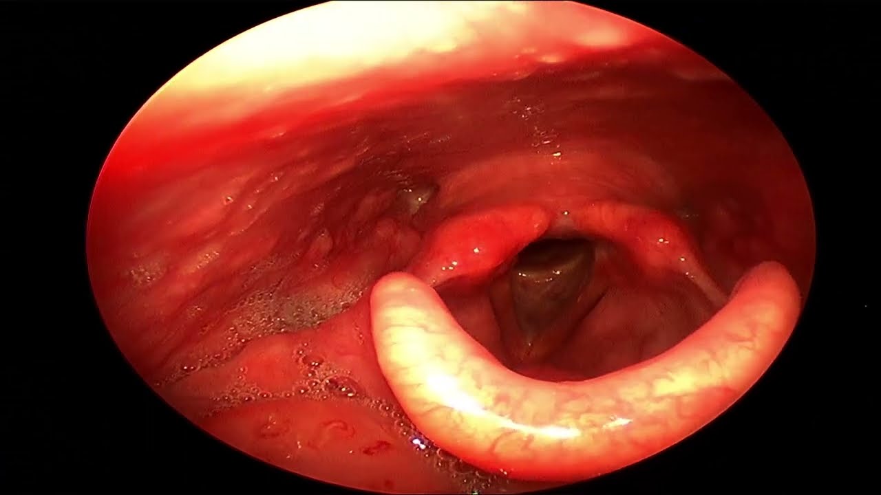 Juan Carlos Mendez Gutierrez-52