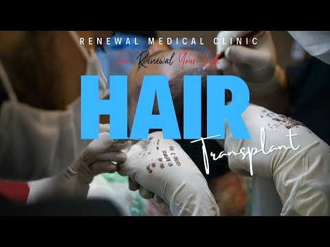 Hair Transplant / Renewal Medical Clinic