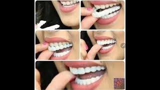 وأخبر الإبتسامة المتحركه هوليوود بثمن مناسب جدا داخل المغرب  snap on smile 😱