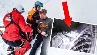 How I broke my COLLARBONE - Behind the Scenes of Fabiolous Escape 2