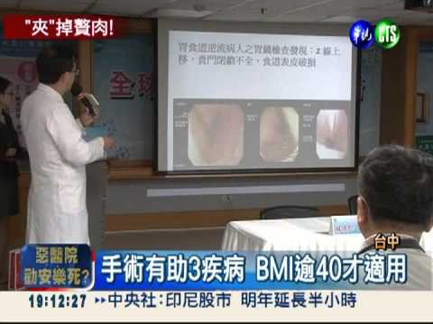 首創"胃夾"減重! 男子甩肉60公斤