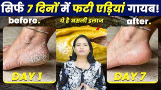 Music video thumbnail preview for फटी एड़ियों से 7 दिनों में छुटकारा! 🦶 | Cracked Heels Home Remedy by Hard Skin