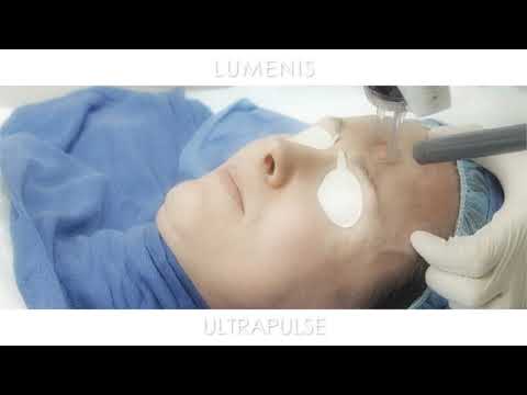UltraPulse Procedure