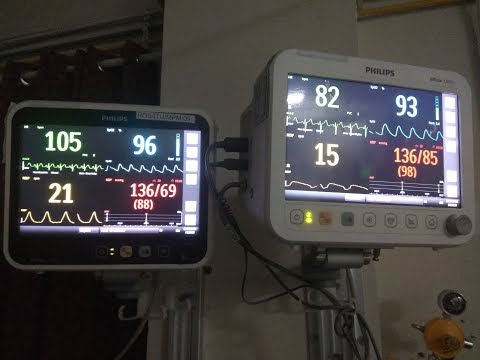 How to use ICU Monitors