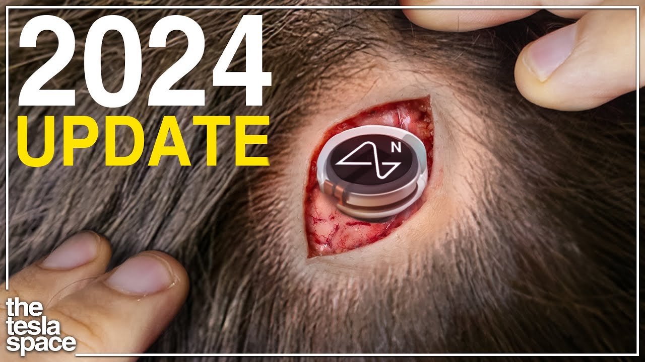 The 2024 Neuralink Update Is Here!