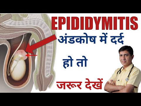Epididymitis Symptoms,Causes And Treatment |Homeopathic Medicine| Testicular Pain |Dr.Ramdeo Lamoria