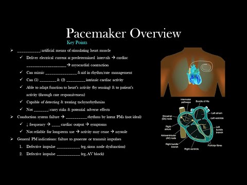 Pacemaker Overview | The EKG Guy - www.ekgguy.com