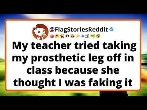 My TEACHER tried TAKING my prosthetic leg off in class because she thought I was faking it...