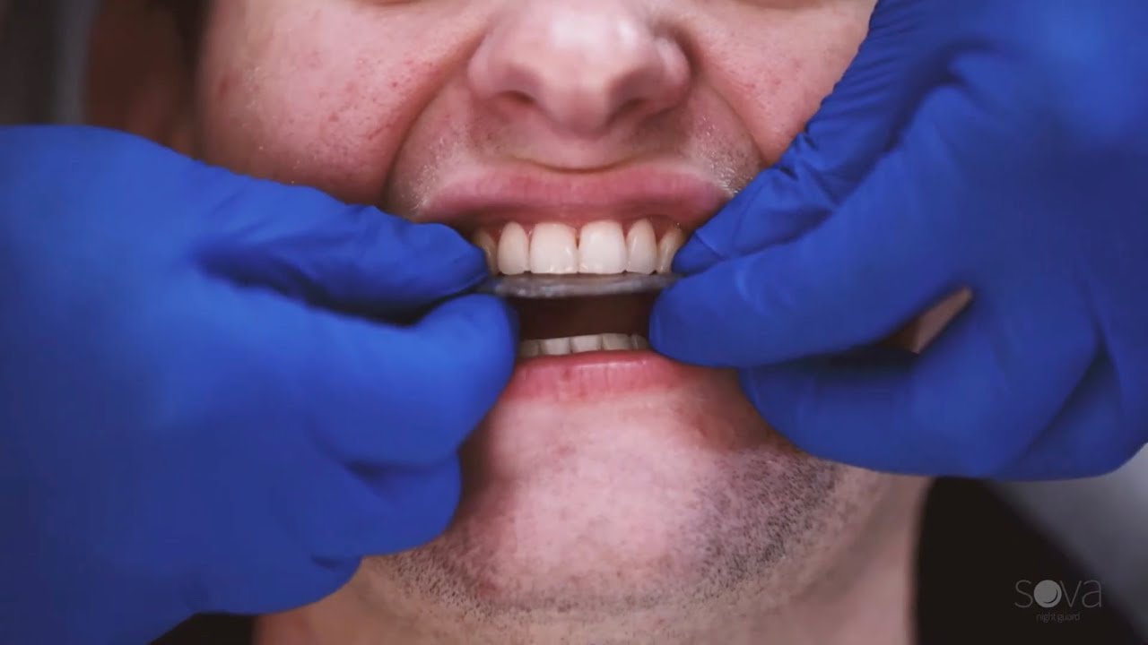 SOVA Clinical Instructions