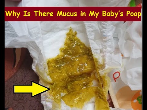 Why Is There Mucus in My Baby’s Poop?