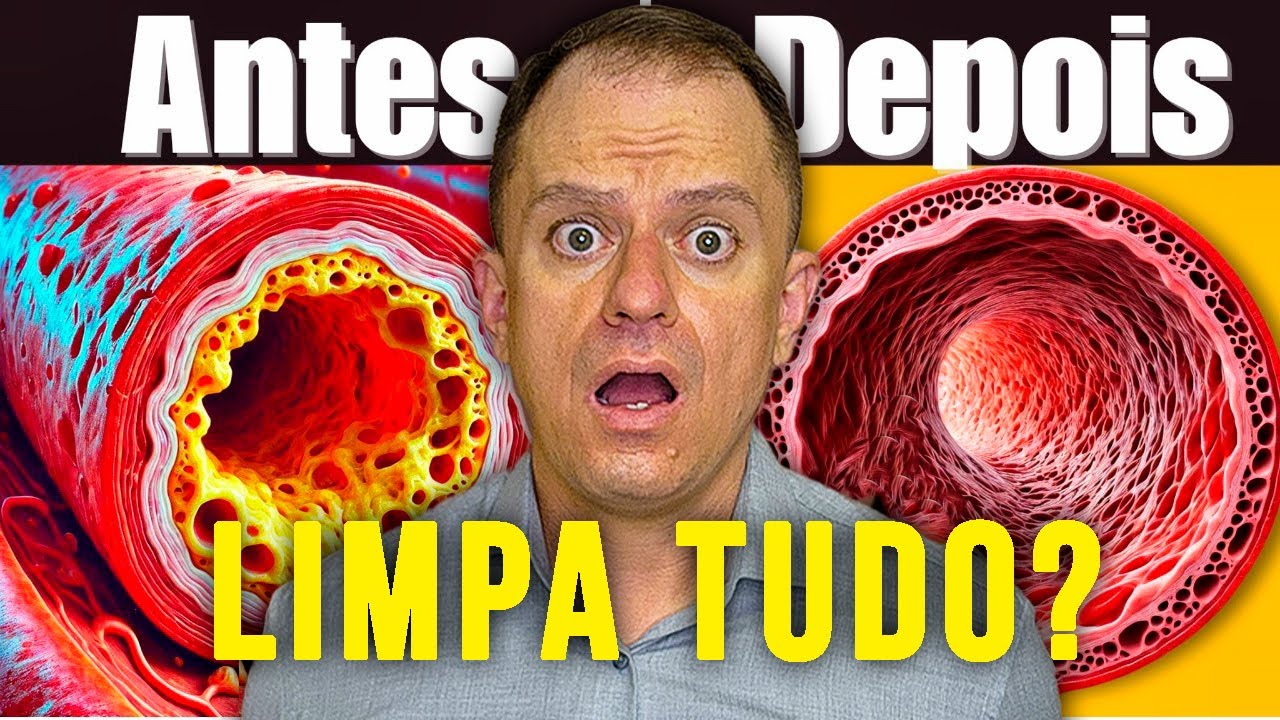 Adeus Artérias Entupidas: Como Limpar Seu Corpo Sem Remédios!