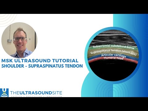 How to find the Supraspinatus tendon of the rotator cuff on MSK ultrasound!