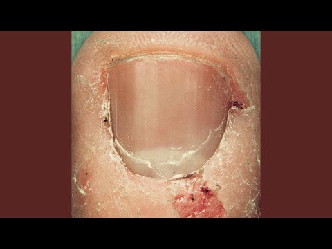 Video thumbnail for Broken Knees