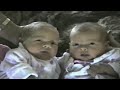 Tape For Gerry Part 2 Linda S Twins