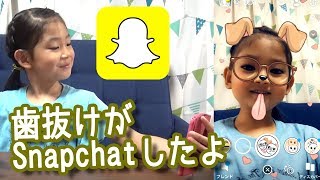 スナップチャットで報告！歯が抜けた！【Snapchat】