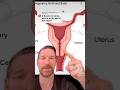 What Happens After A Total Hysterectomy Drrich Doctorrich Womenshealth Hysterectomy Obgyn