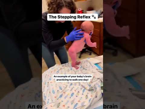 Walking/ Stepping Reflex in the Newborn #pediatrics