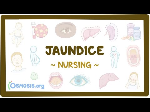 Influenza Clinical Nursing Care