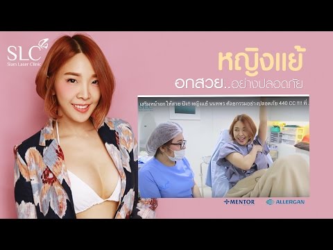 เต้านม implants 375 มล. เพิ่ม Surgut เต้านม