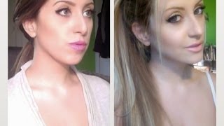 My Jaw Surgery (Before and After)