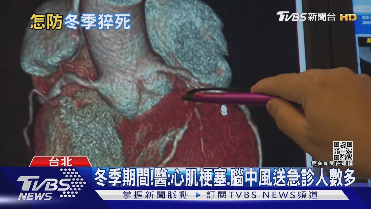 避免猝死...醫師警告別做「這件事」 出現症狀緊急送醫!