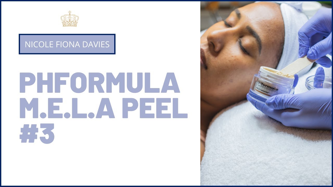 HOW TO GET RID OF HYPERPIGMENTATION | PHFORMULA M.E.L.A PEEL #3 AT DERMAGURU