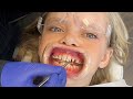 I Had A Crazy Dream I Got Braces Jazzy Skye