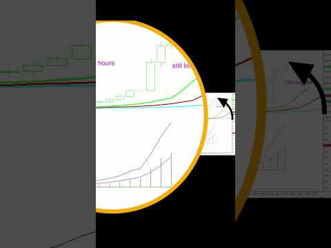 Gold Trade with this MACD Pullback Hack is on FIRE