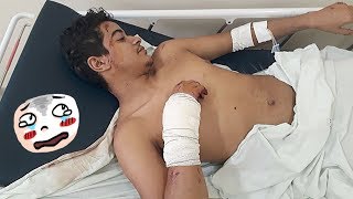 TERMINAMOS E SOFRI UM ACIDENTE