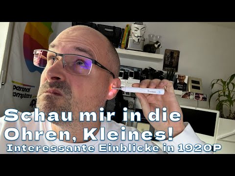 👂🏼🔬 Ohrschmalz mit Computertechnik entfernen? Was sagt der Ohrenarzt dazu?