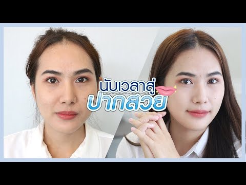 แก้ไขปัญหาปากบนหนาและไม่เท่ากัน ด้วยการศัลยกรรมปากกระจับ ที่ นารดาคลินิก แก้ไขปัญหาปากบนหนาและไม่เท่ากัน ด้วยการศัลยกรรมปากกระจับ ที่ นารดาคลินิก