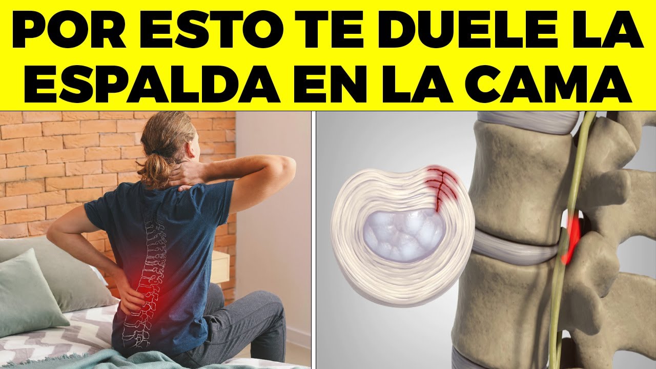 ALERTA! Por Esta Peligrosa Razón Te Duele La Espalda En La Cama! Y CÓMO CURARLO!